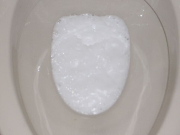 トイレお掃除に強い味方が現れた！